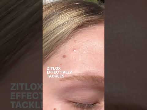 The FDA recalled several skincare brands products because of this ingredient...