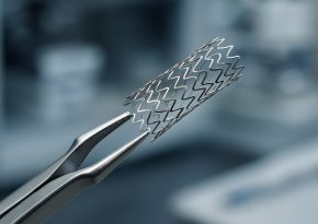 Nickel-Titanium Shape Memory Alloys: Revolutionizing Endovascular Stents in 2025 & Beyond Nickel-Titanium Shape Memory Alloys: Revolutionizing Endovascular Stents in 2025 & Beyond